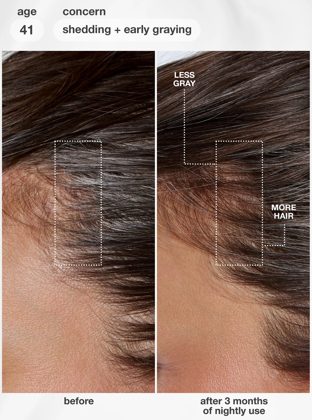 K18: FutureIQ™ biomimetic hair longevity serum