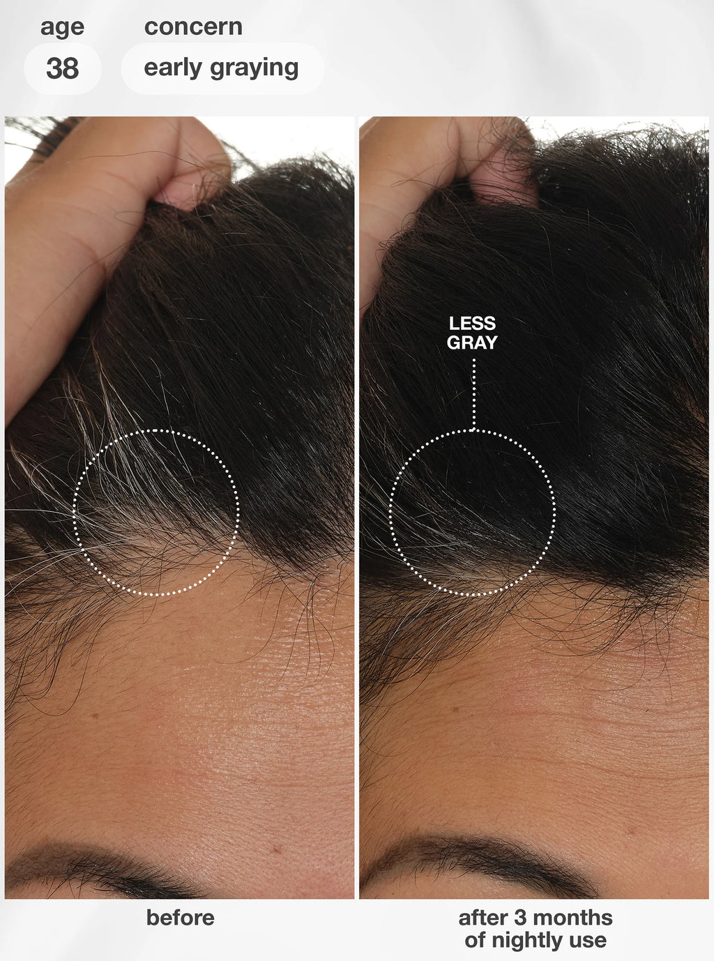 K18: FutureIQ™ biomimetic hair longevity serum