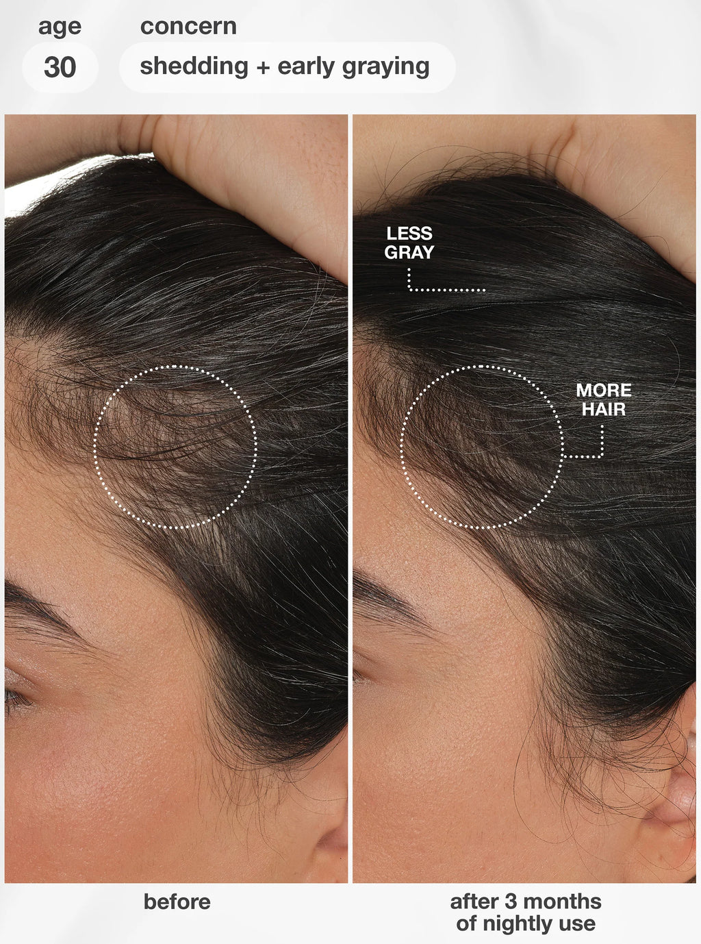 K18: FutureIQ™ biomimetic hair longevity serum